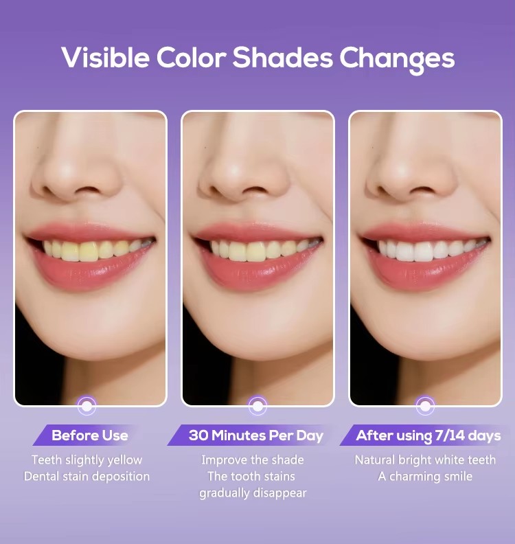 Visible shade changes after 7 to 14 days of use